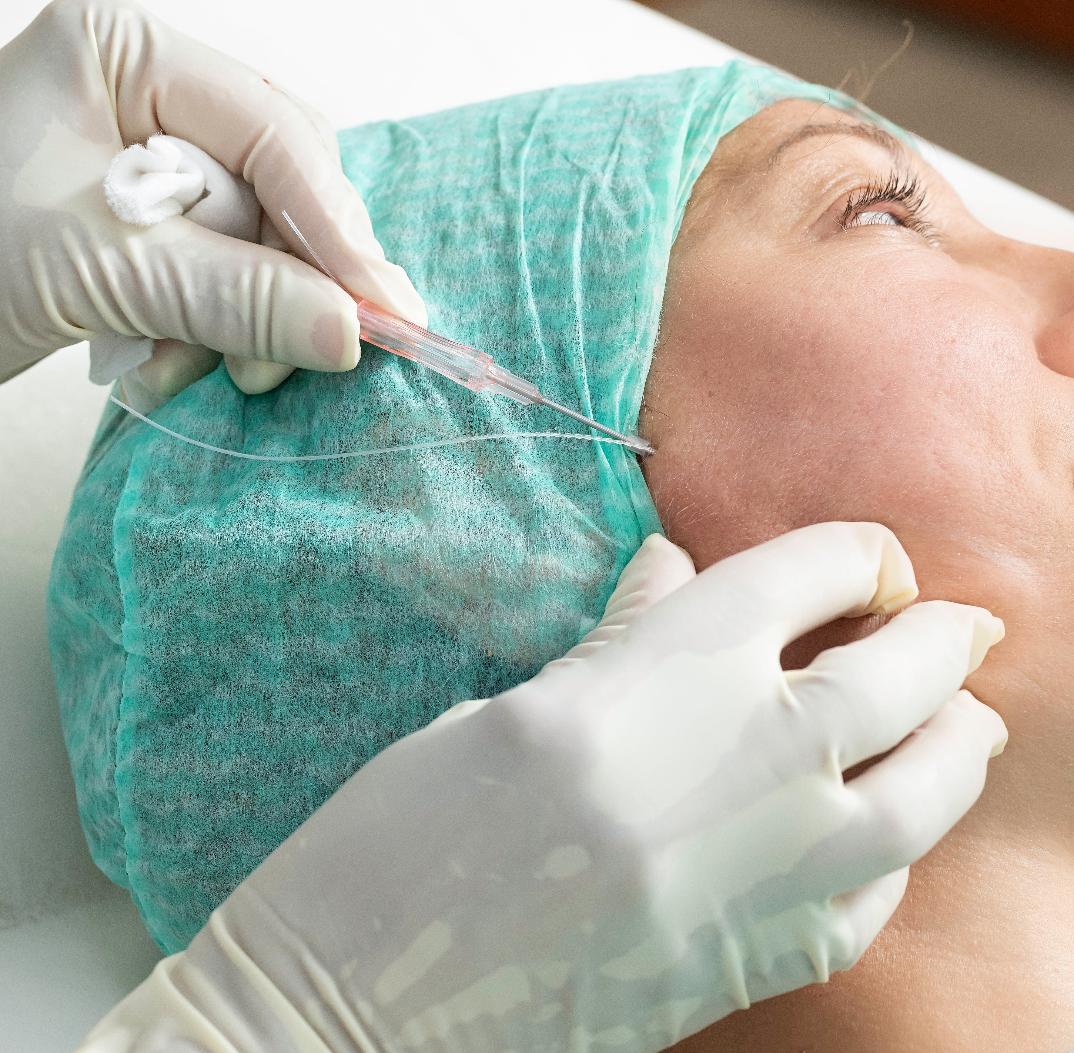Vad är PDO-trådar? – 7H Medical
