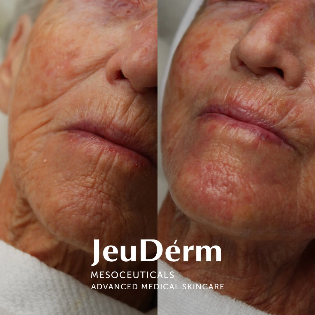 Reform Age O2 Boto Fluid